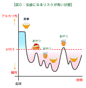 虫歯になるリスクが高い状態