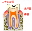 エナメル質のみが酸によって溶けた状態