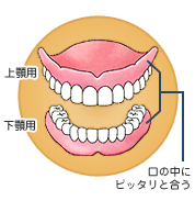 入れ歯のしくみイメージ