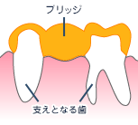 ブリッジイメージ