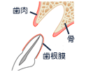 完全脱臼状態イメージ