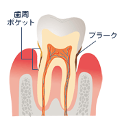 歯イメージ