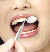 歯周病の検査と診断イメージ